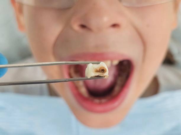 Best Pediatric Emergency Dentist in Kingstree, SC