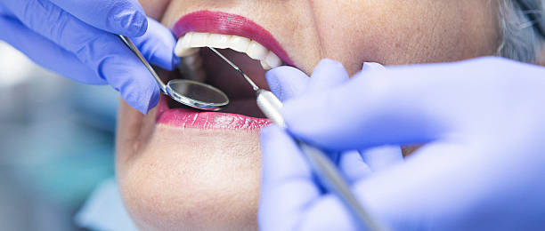 Best Emergency Dental Extractions in Kingstree, SC